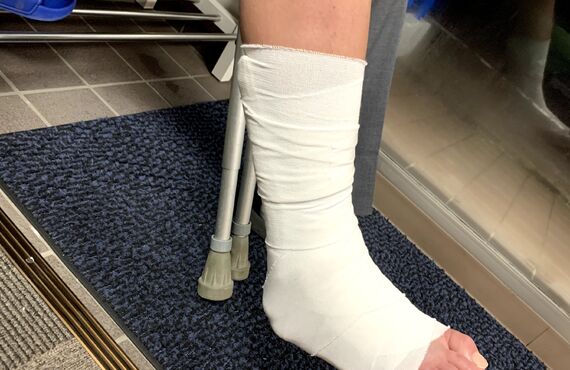 鶴ヶ島の接骨院では足関節捻挫治療にも対応しておりますのでご相談ください