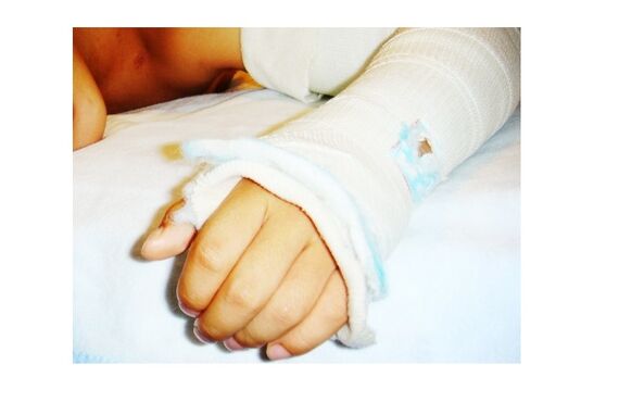 骨折治療は超音波治療ができるこうぞう整体院・接骨院へ